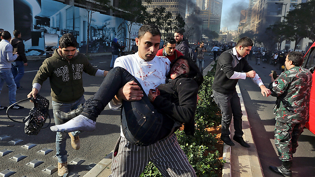 Woman injured by blast (Photo: AP)