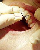 היא היתה מקצועית ולא חייכה אפילו לרגע