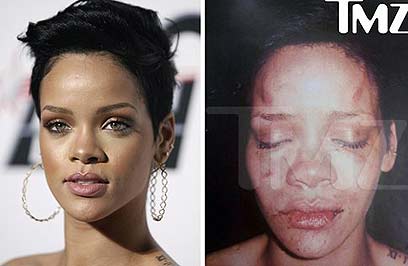 הפנים של ריהאנה אחרי שהותקפה על ידי בראון. וויטני יוסטון חיה ובועטת (צילום: AP) (צילום: AP)