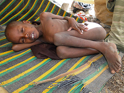 מירוץ נגד הזמן: "כ-400 אלף ילדים עשויים לרעוב"  (צילום: EPA) (צילום: EPA)