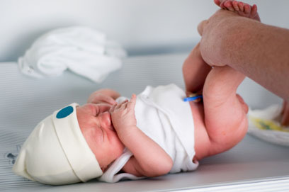 בתוך 24 שעות מומלץ לגשת עם התינוק לבית החולים (צילום: shutterstock ) (צילום: shutterstock )