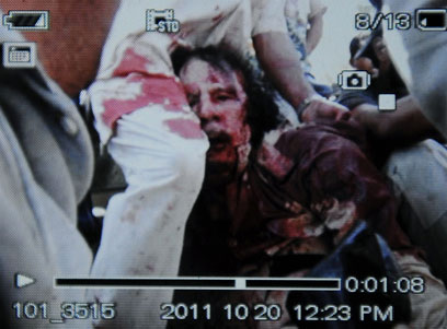 Unconfirmed photo of wounded Gaddafi (AFP)