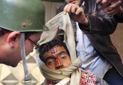 48 שעות של עימותים. מפגין פצוע בקהיר (צילום: AFP) (צילום: AFP)