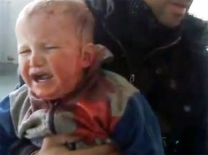 אסד יפסיק את הירי נגד חפים מפשע? תינוק שנפצע מירי כוחות הביטחון הסוריים ()