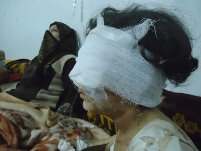אסד ממשיך לטבוח בבני עמו. ילדה סורית שנפצעה בחומס (צילום: רויטרס) (צילום: רויטרס)