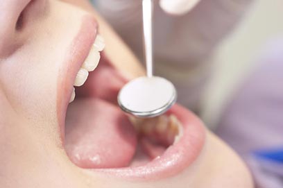 חיטוי הכלים אצל רופא השיניים חייב להיעשות לפני כל מטופל באשר הוא (צילום: ויז'ואל/פוטוס) (צילום: ויז'ואל/פוטוס)