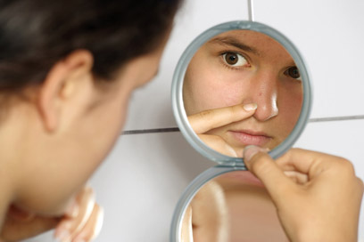 הימנעות משמש ושמירה על היגיינת עור נאותה יעילה למניעת האקנה (צילום: index open) (צילום: index open)