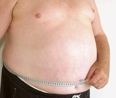 השמנה יכולה לזרז התפתחות מחלות דמנציה (צילום: index open) (צילום: index open)