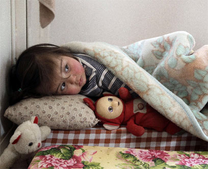 ילדה סורית שברחה ללבנון. "לא דומה לאף קונפליקט אחר" (צילום: AFP) (צילום: AFP)