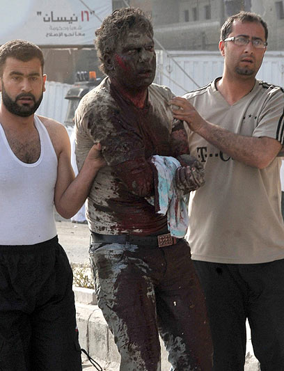 פעולה של טרוריסטים? פינוי פצוע בדמשק, היום (צילום: AFP PHOTO/HO/SANA) (צילום: AFP PHOTO/HO/SANA)
