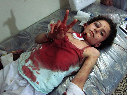 הדיכוי האכזרי נמשך. ילדה פצועה בחומס (צילום: AFP PHOTO / HO / SHAAM NEWS NETWORK) (צילום: AFP PHOTO / HO / SHAAM NEWS NETWORK)
