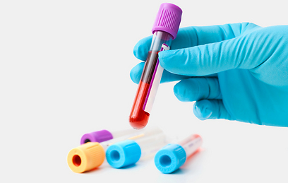 בדיקת דם יכולה לגלות הימצאות החיידק בגוף (צילום: shutterstock) (צילום: shutterstock)