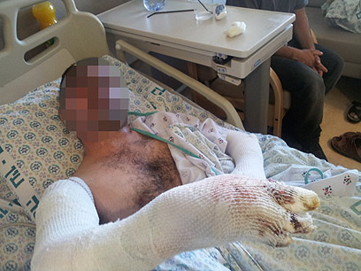 אחד מבני המשפחה הפלסטינית נפצע באורח קשה (צילום: חסן שעלאן) (צילום: חסן שעלאן)