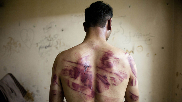 Syrian prisoner tortured by the Assad regime (Photo: AFP)
