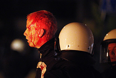 אחד הפצועים באירועים (צילום: EPA) (צילום: EPA)