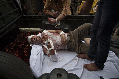 מורד פצוע בחלב (צילום: AFP) (צילום: AFP)