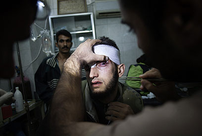 מורד מקבל טיפול רפואי בחלב. דיווחים על התקדמות (צילום: AFP) (צילום: AFP)