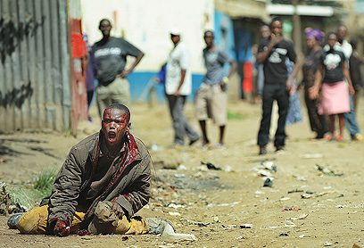 אחד הפצועים במהומות (צילום: AFP) (צילום: AFP)