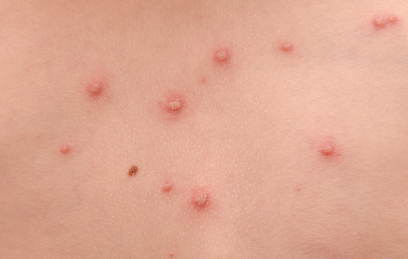 צילום: shutterstock צילום: shutterstock