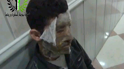 על פי המורדים, אלו אזרחים שנפגעו בהתקפת נשק כימי מצד המשטר ()