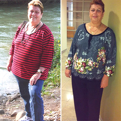 זהבה חנצ'ינסקי לפני הדיאטה (משמאל) ואחריה. "החלטתי לעשות שינוי" ()