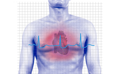 אצל גברים רבים התקף הלב אינו מלווה דווקא בכאב ביד שמאל (צילום: shutterstock) (צילום: shutterstock)