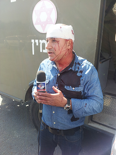 יורם כהן, כתב ערוץ 1, נפצע בהפגנה (צילום: אליאור לוי) (צילום: אליאור לוי)