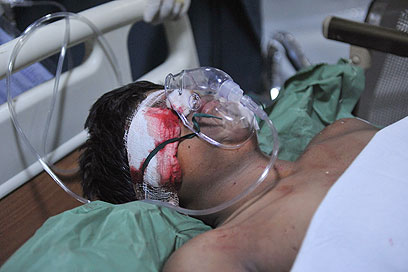 אחד הפצועים (צילום: AFP) (צילום: AFP)
