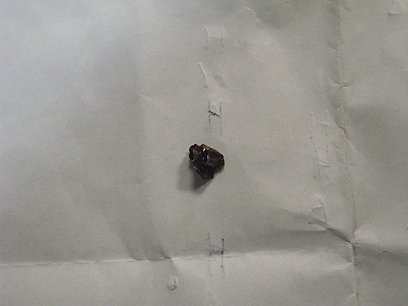 רסיס כדור חי שהוצא מגופו של הפצוע  (צילום: זכריה סדה, רבנים למען זכויות האדם) (צילום: זכריה סדה, רבנים למען זכויות האדם)