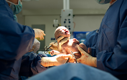 ניתוח קיסרי. הלידה הבאה יכולה להיות רגילה (צילום: shutterstock) (צילום: shutterstock)