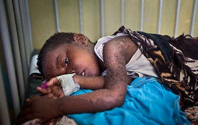 הערכה של ממשלת בריטניה קבעה כי כ-100 אלף בני אדם מתו מרעב בסומליה (צילום: AP) (צילום: AP)