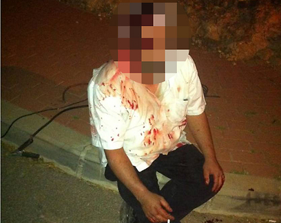 צילום: מוישי שפיץ - סוכנות תצפית