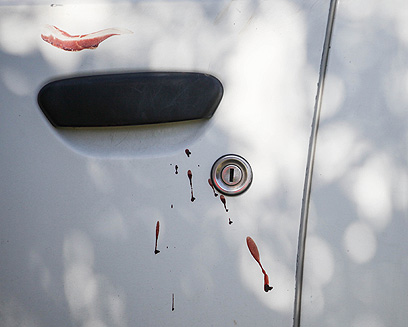 כתמי דם על מכוניתו של הדוקר (צילום: אבישג שאר-ישוב) (צילום: אבישג שאר-ישוב)