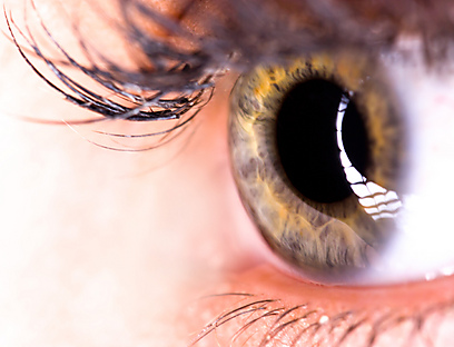 ניתוח תיקון הראייה הסתבך - המטופלת תפוצה ביותר ממיליון שקל (צילום: shutterstock) (צילום: shutterstock)