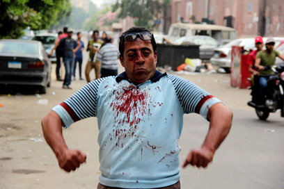 פצוע בעימותים ליד האוניברסיטה (צילום: AFP) (צילום: AFP)