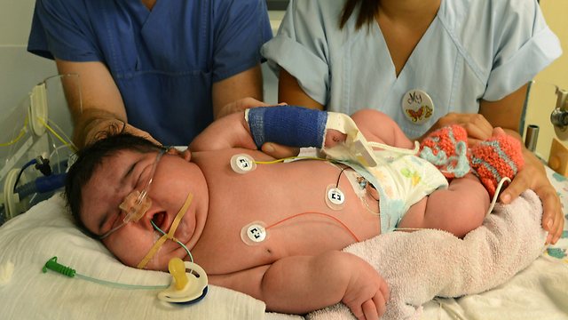 לרוב תינוקות נולדים במשקל כבד בגלל סוכרת הריון. ג'סלין בבית החולים (צילום: AP) (צילום: AP)