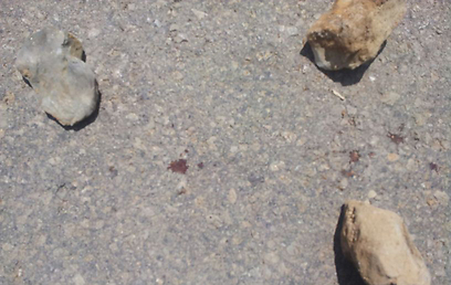 Traces of blood seen in Al-Manar photo