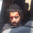 Haredi injured in clashes