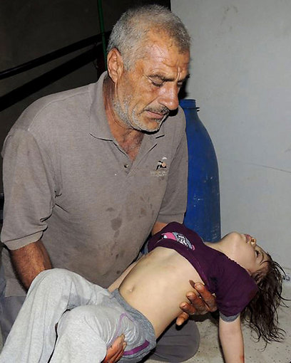גבר נושא את קרובתו הפצועה. לטענת המורדים הילדה נפגעה מגז בעיירה ארבין (צילום: AP) (צילום: AP)