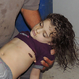 Victim of chemical attack