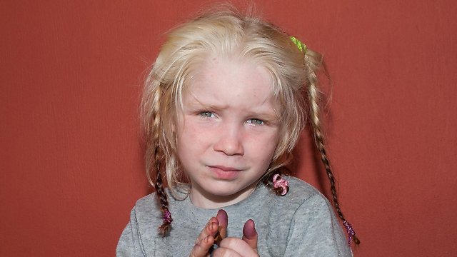 תמונה של הילדה שהועברה לחזקת הרשויות. "מראה נוצל לאיסוף נדבות" (צילום: רויטרס) (צילום: רויטרס)