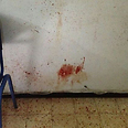 Wife attacked with axe
