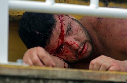 אוהד של פרנאנסה שותת דם אחרי האירועים האלימים (צילום: AFP) (צילום: AFP)