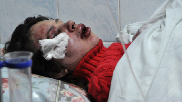 צ'ורנוביל הנפוחה במיטת בית החולים (צילום: רויטרס) (צילום: רויטרס)