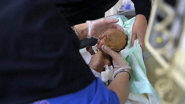A newborn Iranian baby (Photo: AP)
