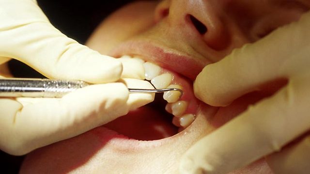 טיפול שיננית יכול לגרום לתחושת רגישות בשיניים (צילום: index open) (צילום: index open)