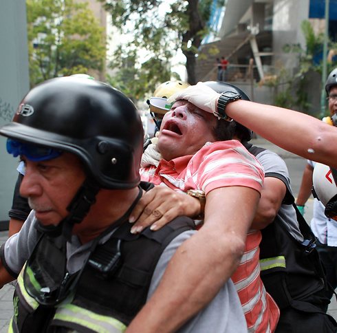 כבאים מפנים מפגין אופוזיציה שנפצע במהלך הפגנה נגד נשיא ונצואלה ניקולס מדורו בקראקס (צילום: AFP) (צילום: AFP)