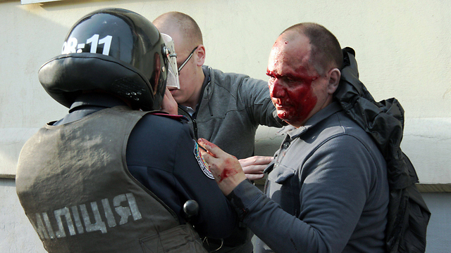 אוהד כדורגל בחרקוב שנפצע בעימותים בין פרו-רוסים לתומכי הממשלה בקייב (צילום: AFP) (צילום: AFP)