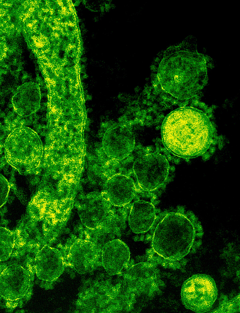 כך נראה הווירוס בצילום מיקרוסקופ (צילום: רויטרס) (צילום: רויטרס)