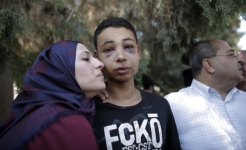 Tariq Abu Khdeir with his mother. (Photo: AFP)